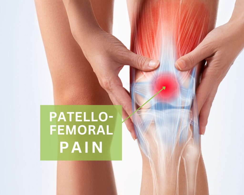 Weak Glutes and Knee Pain » The BioMechanics Method