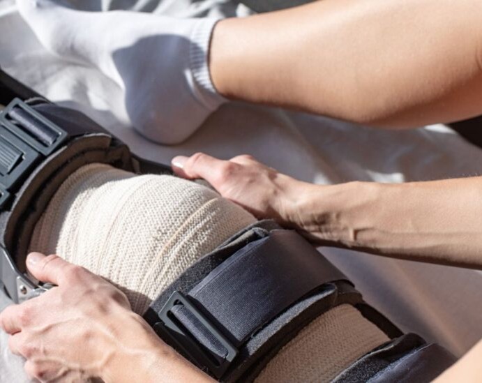 ACL knee rehab physio Sydney